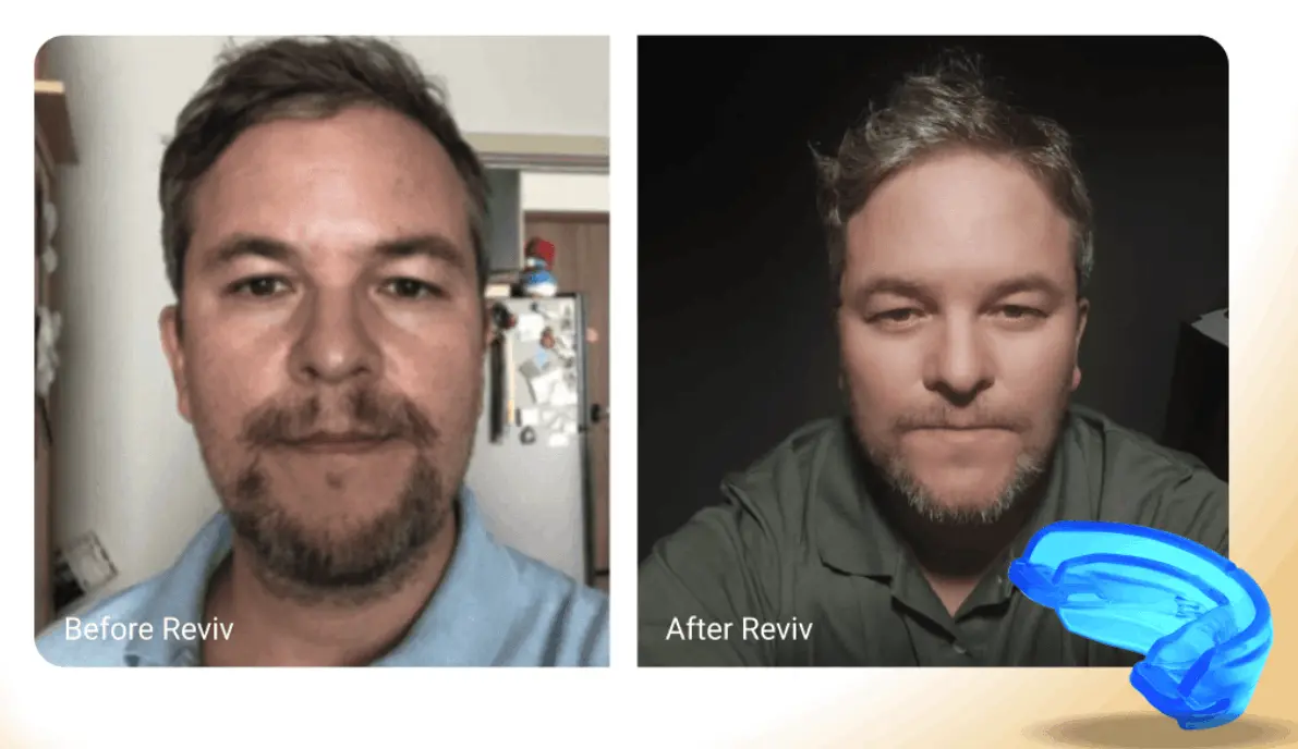 revive mouthguard buy